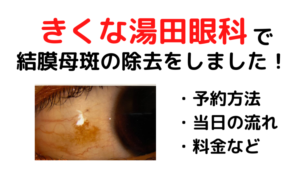 きくな湯田眼科　結膜母斑の除去　体験談　ブログ　保険適用